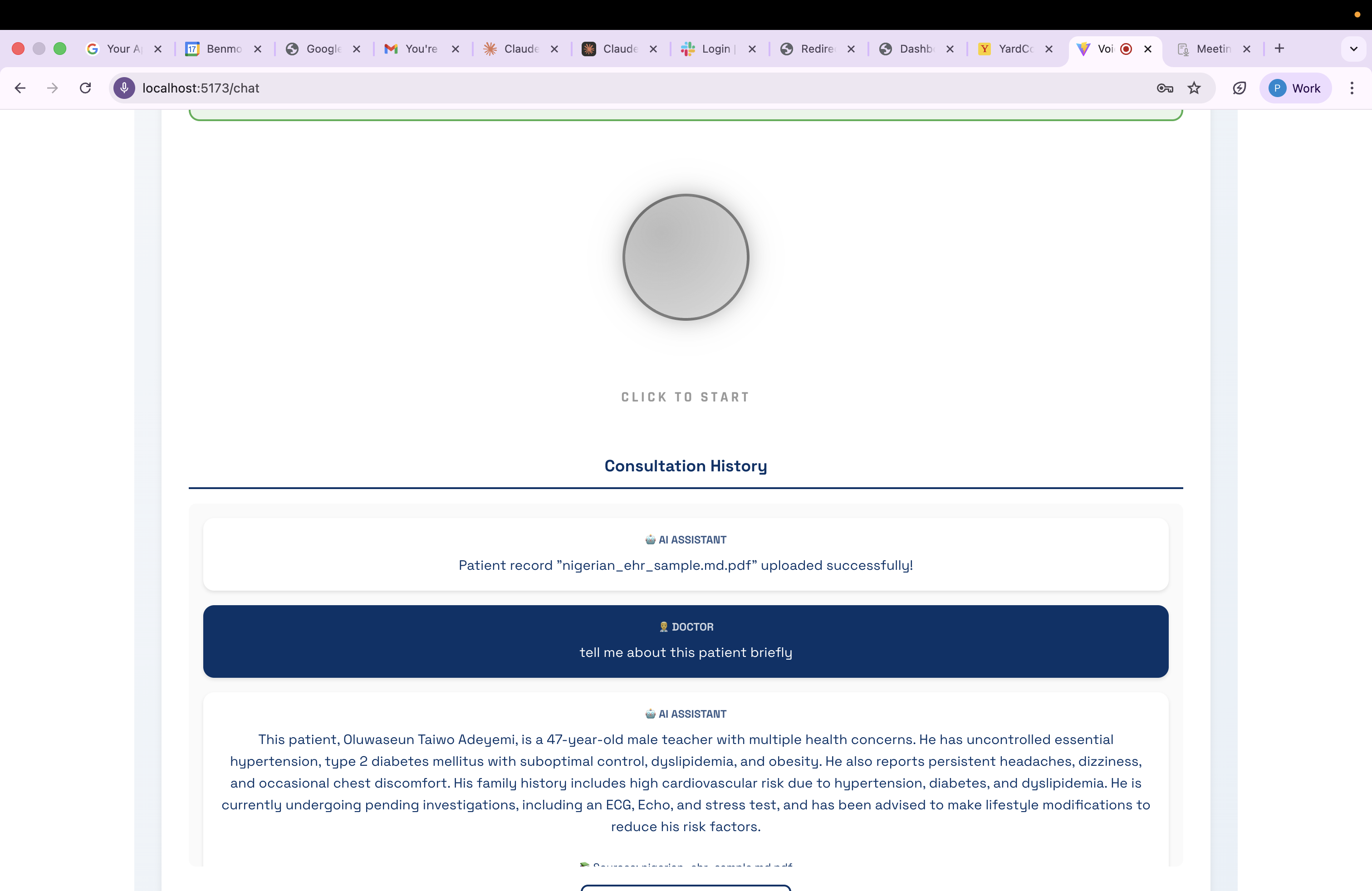 EchoMind voice consultation interface